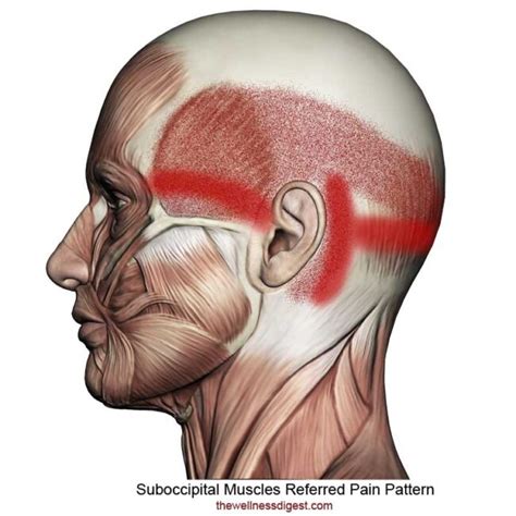 How To Release Tight Suboccipital Muscles HEADACHE RELIEF, 51% OFF