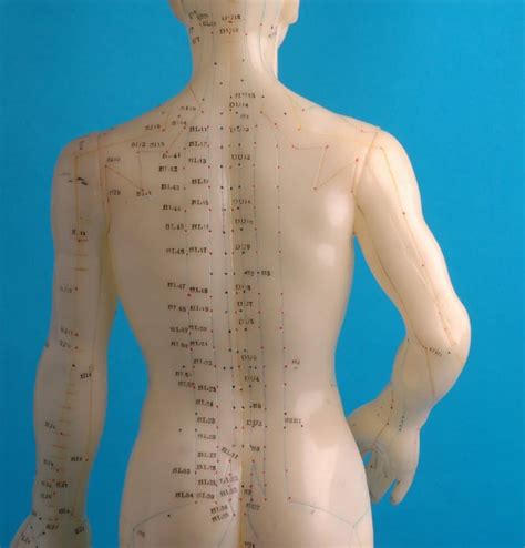 Acupuncture Therapy at Taunton Chiropractors Centre