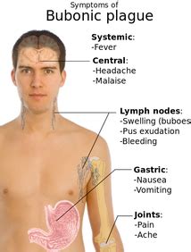 Symptoms, Treatments, Prevention and Death Toll - The Bubonic Plague