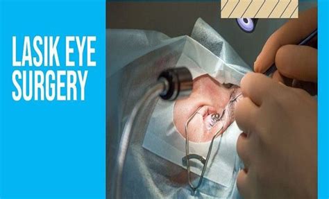 Everything You Need to Know About LASIK Eye Surgery - Health Perfect Info