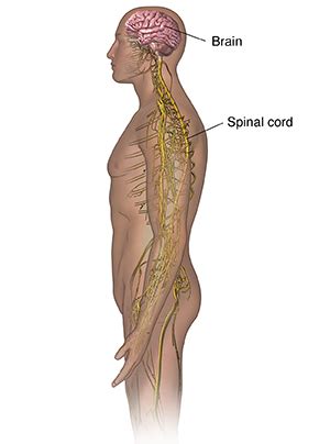 Amyotrophic Lateral Sclerosis (ALS) | Cedars-Sinai