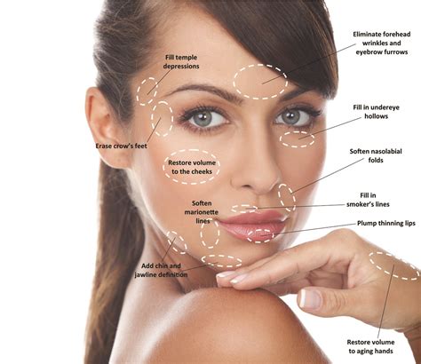 Beginner's Guide to Dermal Fillers. What to Expect? - Medwell Aesthetics