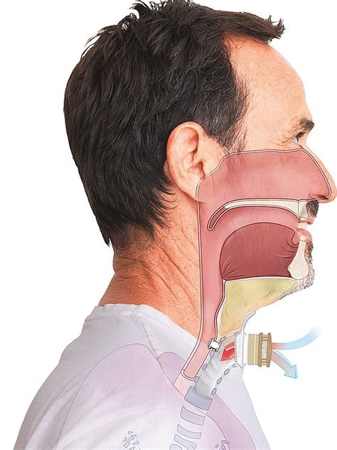 How does an HME filter work? | Fahl