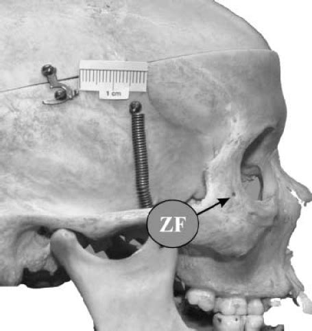 Level 39 - 1 - 15 - Anatomy Sections #Asu - Memrise