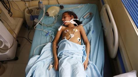 More than 70,000 killed in Yemen's civil war: ACLED | Yemen News | Al ...
