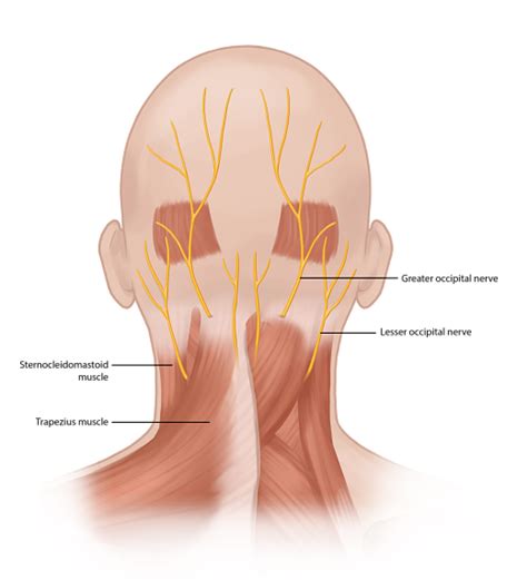 Occipital Nerve Block | Occipital neuralgia Treatment | Pain Spa, Bristol, UK