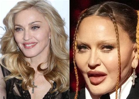 'Looks like it hurts': Madonna's 'new face' shocks fans [photos]