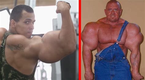 How Not to Lift: Top 10 Synthol Superstars