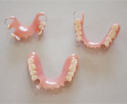 Partial Dentures — Dinos Denture Clinic