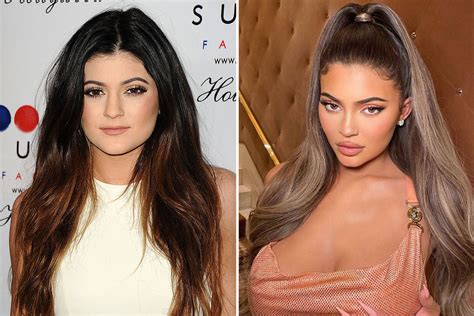 What did Kylie Jenner look like before and after lip filler? | The US Sun