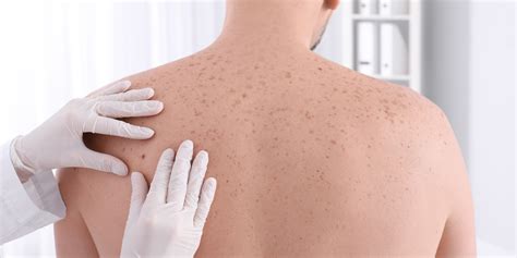 Skin Cancer Diagnosis | San Luis Obispo | Coastal Dermatology