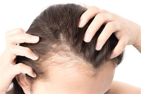 Hair fall treatment - 🧬 Andro Genetic