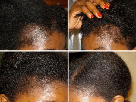 Chebe Hair Grease – Madani Naturals