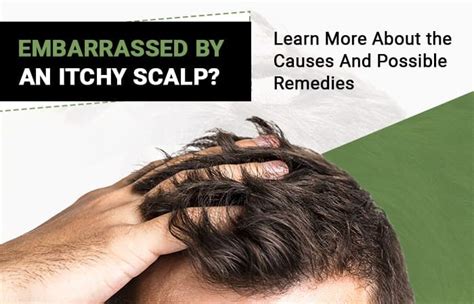 Embarrassed By An Itchy Scalp? Learn More About Possible Remedies