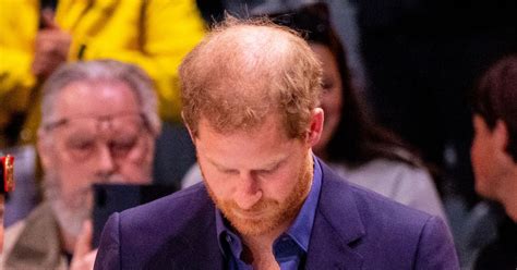 Prince Harry ‘close to tipping point’ of losing hair - Daily Star