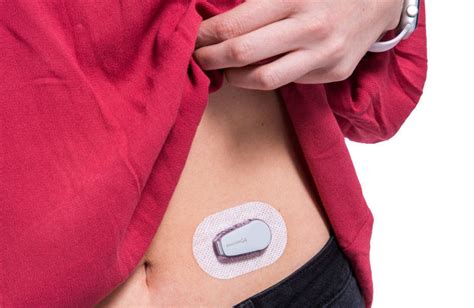 Dexcom G6 Continuous Glucose Monitoring is Now Fully Subsidised - AMSL Diabetes