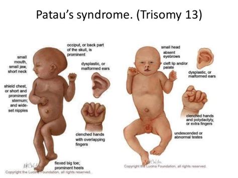 Kisah Bayi Mungil Adam Begitu Mengharukan. Ini Fakta yang Mesti Kamu ...