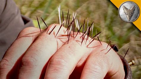 YIKES! Quilled by a Porcupine! - YouTube