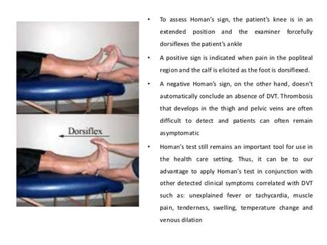 Deep Vein Thrombosis