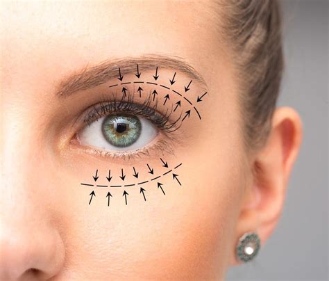 Blepharoplasty Surgery: Costs, Recovery, & More – NVISION