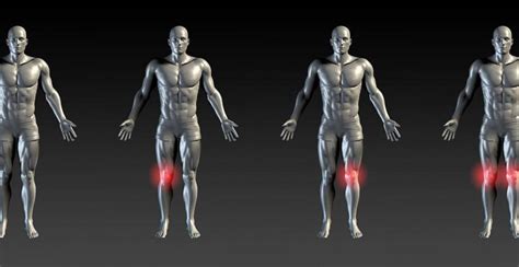 ACL & MCL Tears: Progressive Spine & Sports Medicine: Pain Medicine