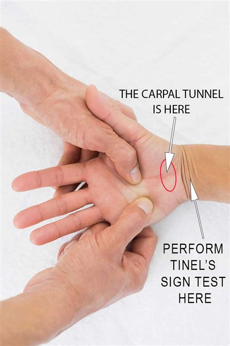 Self Test For Carpal Tunnel | The Carpal Solution