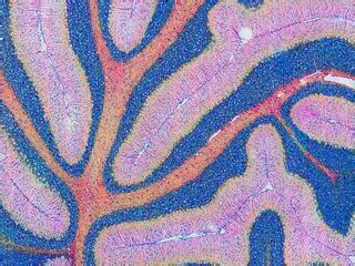 Mouse cerebellum in pink and blue | The cerebellum is the br… | Flickr