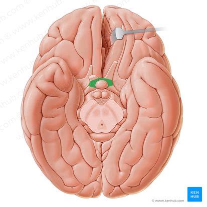 Arteria communicans anterior - Anatomie, Verlauf u. Äste | Kenhub