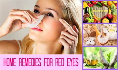 26 Tips Natural Home Remedies for Red Eyes Relief
