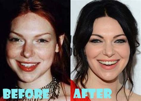 Laura Prepon Plastic Surgery Before and After Photos - Lovely Surgery | Celebrity Before and ...