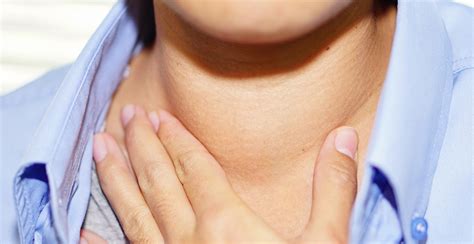 Goiter Overview: Causes & Symptoms | RxSaver