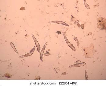 Demodex Mange Microscope View Stock Photo 1228617499 | Shutterstock