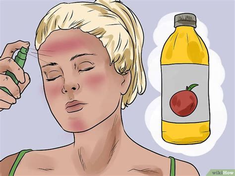 How to Prevent Skin Peeling After Sunburn: 14 Steps Face Peeling From Sunburn, Sunburn On Face ...