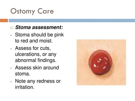 PPT - Ostomy care PowerPoint Presentation - ID:1972840