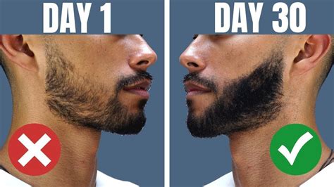 How To Grow A Beard If You Cant Grow Facial Hair | WORKS 100% Of The ...