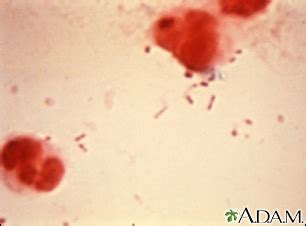 Haemophilus Influenzae Type B Gram Stain