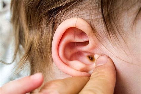 Giải đáp: Trẻ bị viêm tai giữa có tiêm phòng được không?