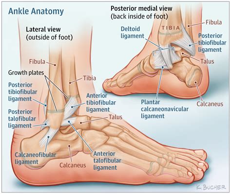 Ankle Sprains in Youth: This Patient Page discusses how to treat ankle ...