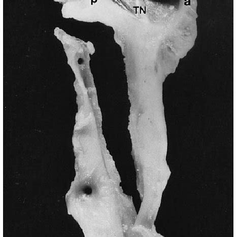 Coronal CT scan of a pig head. The mastoid air cell system (straight... | Download Scientific ...