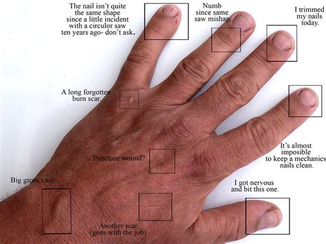 Left Hand Anatomy