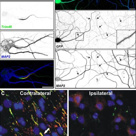 (PDF) Axon initial segments: structure, function, and disease: Axon initial segments