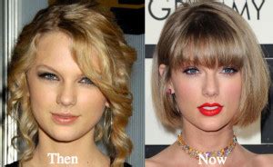 Taylor Swift nose job - Latest Plastic Surgery Gossip And News. Plastic ...