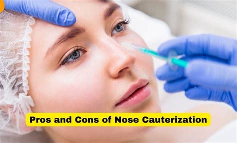 Pros And Cons Of Nose Cauterization: 10 Facts About Nose Cauterization ...