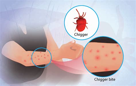 Health Condition : Symptoms, Causes, Treatment and More