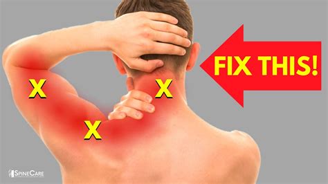 Lessons I Learned From Info About How To Relieve Pain In The Neck ...