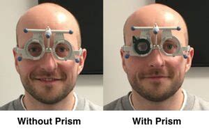 Prism Correction : Working, Instructions To Use And Prescription.