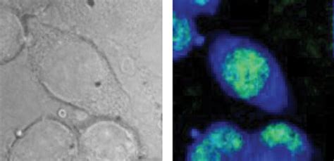 Faster CARS, less damage: Chemical microscopy shows potential for cell diagnostics