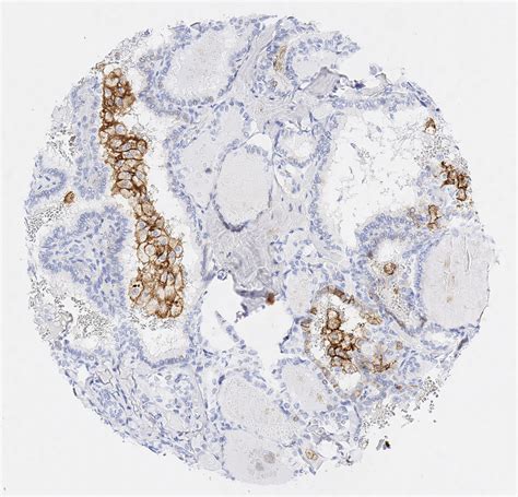 PD-L1 antibody | ONCOdianova anti-human PD-L1 antibody for IHC