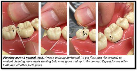 Is flossing really that important? > Wright-Patterson AFB > Article Display