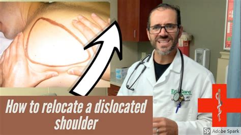 how to put a shoulder back, dislocated shoulder treatment - YouTube